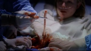 Tapeworm featuring in House MD season 3 episode 14 [upl. by Ydnat39]