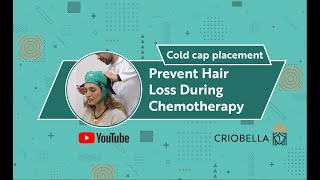 Criobella Cold Cap Placement StepbyStep Guide with Demonstration [upl. by Caprice389]