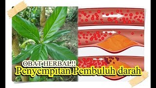 CARA HERBAL MENGOBATI PENYEMPITAN PEMBULUH DI JANTUNG [upl. by Fife955]