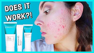 Does Proactiv MD Really Work Honest 2 Month Review [upl. by Hoisch]