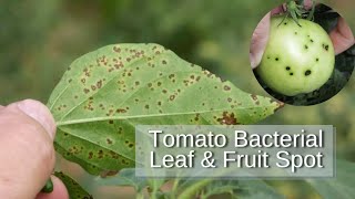 ಬ್ಯಾಕ್ಟೀರಿಯಲ್ ಎಲೆ ಚುಕ್ಕಿ ರೋಗ Bacterial Leaf amp fruit Spotsymptoms amp control measuresDr A Venugopal [upl. by Amoakuh]