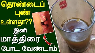 1 கிளாஸ் போதும் தொண்டைப் புண் ஆறிவிடும்  thondai pun tamil maruthuvam  Throat Pain  thondai vali [upl. by Draper988]