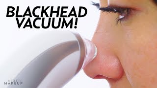 I Tried a Blackhead Remover Pore Vacuum  Beauty with Susan Yara [upl. by Guimar]