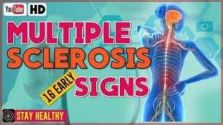 16 Multiple Sclerosis Symptoms Early Warning Signs [upl. by Nywnorb]