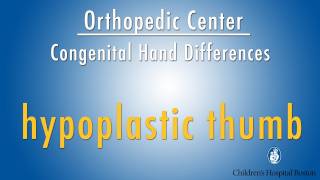 hypoplastic thumb  congenital hand differences  Boston Childrens Hospital [upl. by Enelrahc406]