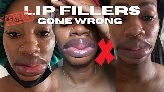 STORYTIME I GOT LIP FILLERS  TANAANIA [upl. by Aevin]