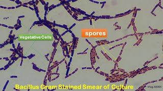 Spore staining and Microscopy at 1000X2000X and 4000X Magnifications [upl. by Karub]