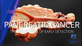 Pancreatic Cancer The Importance of Early Detection [upl. by Lekram]