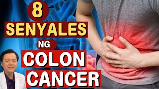 8 Senyales ng Colon Cancer  Payo ni Doc Willie Ong Internist and Cardiologist [upl. by Seligmann405]