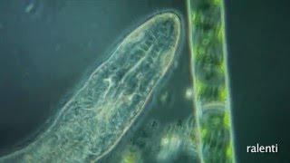 Stenostomum leucops turbellarié deau douce [upl. by Regine]