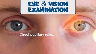 Examination of the Eyes and Vision  OSCE Guide old version  UKMLA  CPSA [upl. by Oscar]