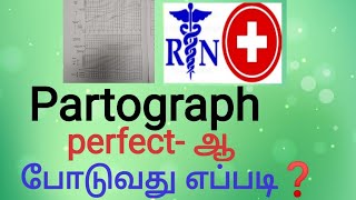 Partograph and its importanceHow to put perfect partograph in tamil [upl. by Ezra]