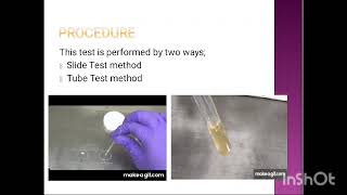 Coagulase Test Explained in Urdu [upl. by Anahsohs]