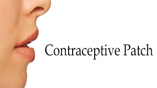 How to Pronounce Contraceptive Patch [upl. by Zeiler]