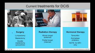 DCIS What You Need to Know [upl. by Tufts]