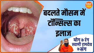 Yoga For Tonsils  बदलते मौसम में टॉन्सिल्स की समस्या काफी बढ़ रही है जानिए खुद को कैसे बचाए [upl. by Gildas]