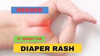 14 HOME REMEDIES FOR BABY DIAPER RASH [upl. by Olocin884]