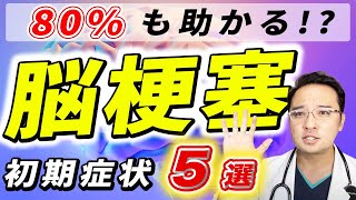 【放置厳禁】80も助かる 脳梗塞 の 初期症状 ５選 [upl. by Guerin]