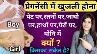 प्रेगनेंसी में खुजली क्यों होती है  Itching During Pregnancy ReshusVlogs ReshusBabyCare [upl. by Barclay]