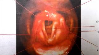 How to identify anatomical landmarks during FEES amended [upl. by Jerusalem]