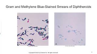 Aerobic Gram Positive Bacilli [upl. by Bax549]