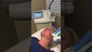 Rosacea Treatment with IPL [upl. by Skelton]