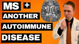 MS  Another Autoimmune Disease Treatment Options [upl. by Wenz]