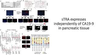 sTRA glycans express independent of CA199 glycans on pancreatic cancer PDAC Code 694 [upl. by Seely]