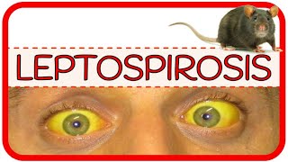 LEPTOSPIROSIS – fisiopatología microbiología signos y síntomas diagnóstico y tratamiento [upl. by Ethelbert4]