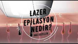 Diode Lazer Epilasyon Nedir Nasıl Çalışır [upl. by Bord]