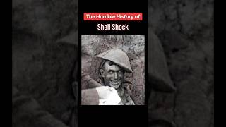 The Shocking History of “Shell Shock” [upl. by Aik]