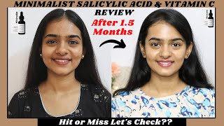 MINIMALIST SALICYLIC ACID AND VITAMIN C REVIEW🔥HONEST REVIEW AFTER 15 MONTHS💯REVIEW IN TAMIL👍 [upl. by Dyolf]