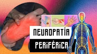 Neuropatía periférica [upl. by Mcfarland]