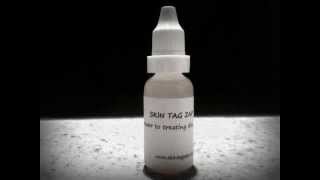 Skin Tag Remover  removing skin tags the natural way Skin Tag Zap [upl. by Soisinoid172]