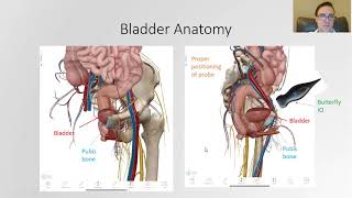 How to Complete a Bladder Scan with the Butterfly iQ [upl. by Shanney]