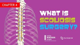 Ch 4  What is Scoliosis Surgery [upl. by Favin]