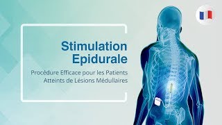 Stimulation Epidurale Procédure Efficace pour les Patients Atteints de Lésions Médullaires [upl. by Elokyn]