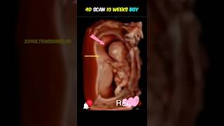 10 weeks 2 days 4D ultrasound very happy babybaby babyboy pregnant [upl. by Bixler]