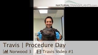 Norwood 3 Patient Procedure Day A Behind The Scenes Look  Dr Blumenthal Travis [upl. by Czarra]