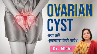 😱Ovarian Cyst क्या होता है क्यों होता है❇️Ovarian Cyst से कैसे छुटकारा पाएं Ovarian Cyst in Hindi [upl. by Wyatan]