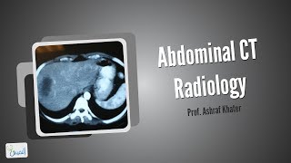 Abdominal CT Radiology  Surgery [upl. by Lina]