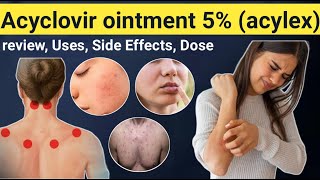 Acyclovir Ointment Uses  Review Acylex ointment uses Side effects contraindications [upl. by Aihsekyw]