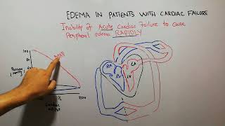 CVS 220  Pathophysiology of Edema in cardiac failure [upl. by Brian933]