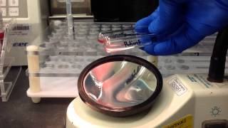 Blood Bank Antibody Screen Tube Method [upl. by Thetes]