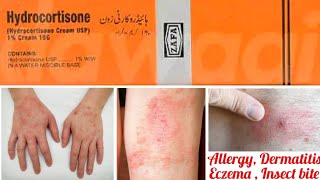 Hydrocortisone 1 Cream uses in Urdu Hindi  Dermatitis Eczema [upl. by Bessy]