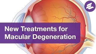 Treatments for Macular Degeneration to Help Preserve Your Vision [upl. by Hniht]