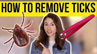 HOW TO REMOVE A TICK THE RIGHT WAY  Dermatologist DrDrayzday [upl. by Uel]