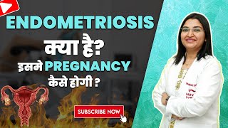 Endometriosis क्या है  What is Endometriosis  Symptoms amp Treatment [upl. by Nylorak]