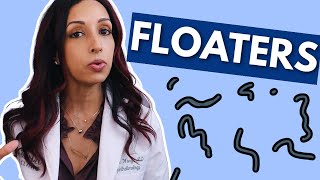 What Causes Eye Floaters Eye Doctor Explains [upl. by Paryavi]