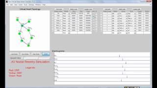 VHM Virtual heart model AVNRT simulation [upl. by Jonathon]